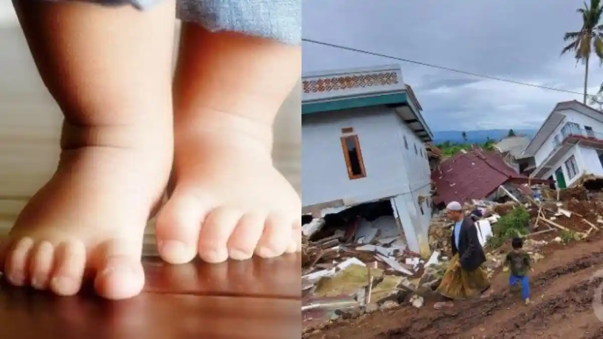 Diselamatkan Nenek dari Reruntuhan, Balita Kini Trauma Gempa Ada Getaran Sedikit Langsung Menjerit