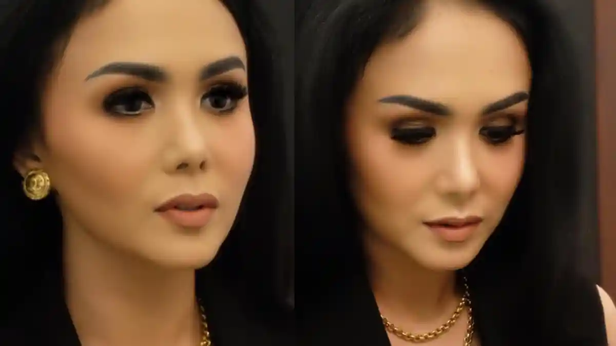 Begini Reaksi Yuni Shara saat Ditawari Perawatan Wajah ala Krisdayanti