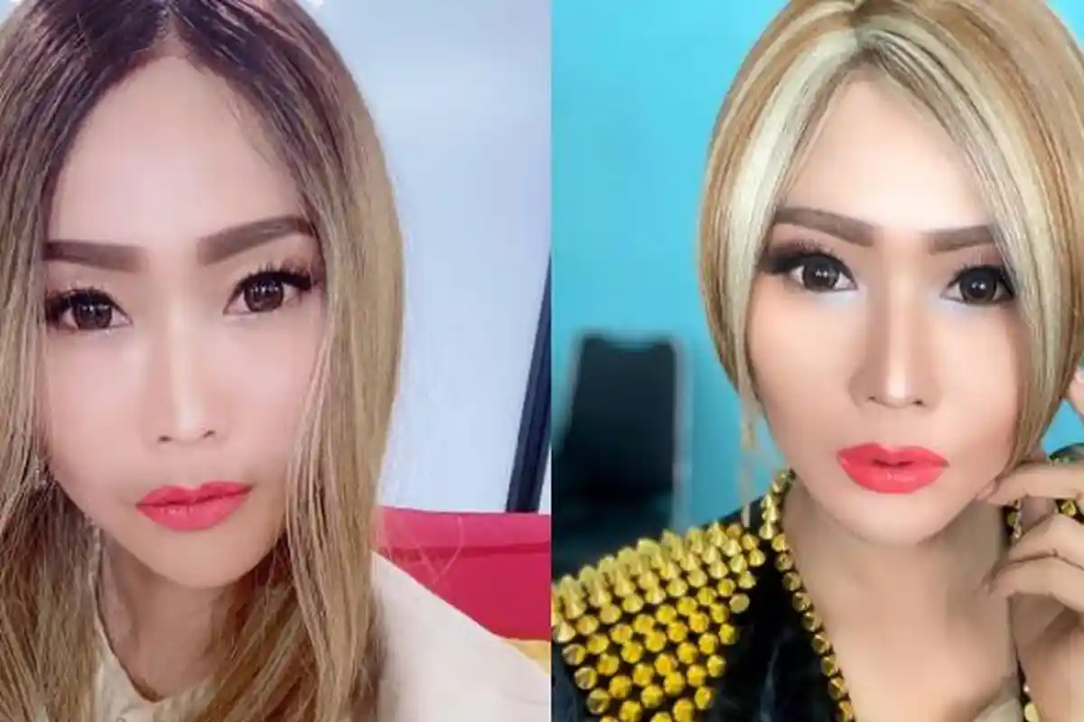 Wajah Tirus Inul Daratista Berubah Drastis Jadi Bulat, Muka Bengkaknya Justru Dipuji Imut dan Lucu