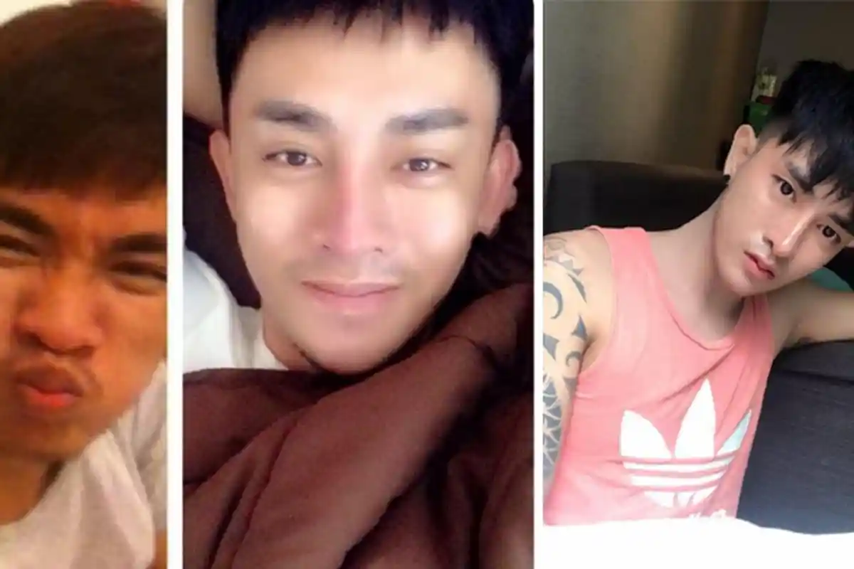 7 Proses Transformasi Oplas Pria Asal Thailand Ini Juara Banget, Bersakit Dahulu Tampan Kemudian