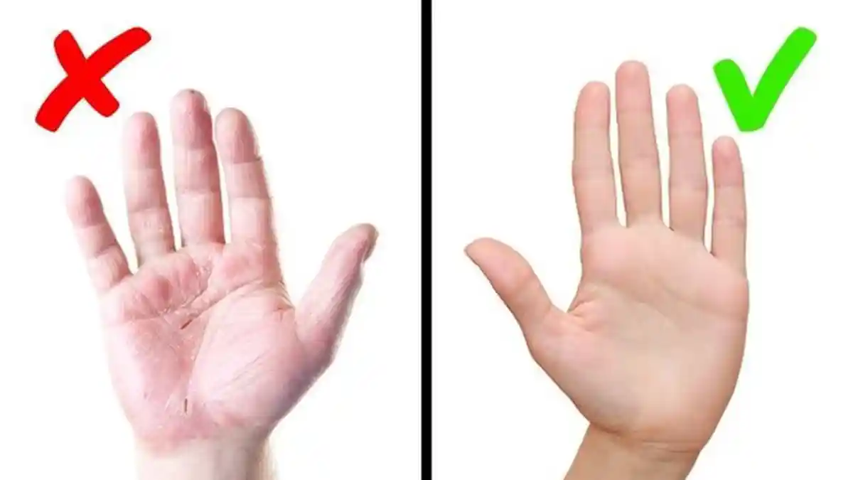 TIPS CANTIK HARI INI - 3 Bahan Alami yang Dapat Menghilangkan Keriput di Tangan, Jadi Lebih Mulus!