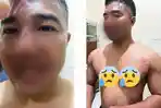 Taufik-Nur-pasca-dianiaya-diduga-seorang-anggota-polisi.jpg