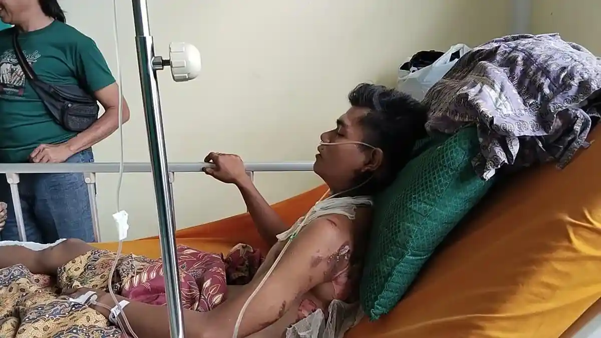 Kabel Terjuntai ke Jalan, 2 Warga Kepahiang Bengkulu Jadi Korban Tersengat Listrik