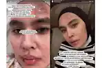 Sembuh dari Sakit, Kartika Putri Jawab Sindiran dr Richard Lee soal Pilih Berobat ke Singapura