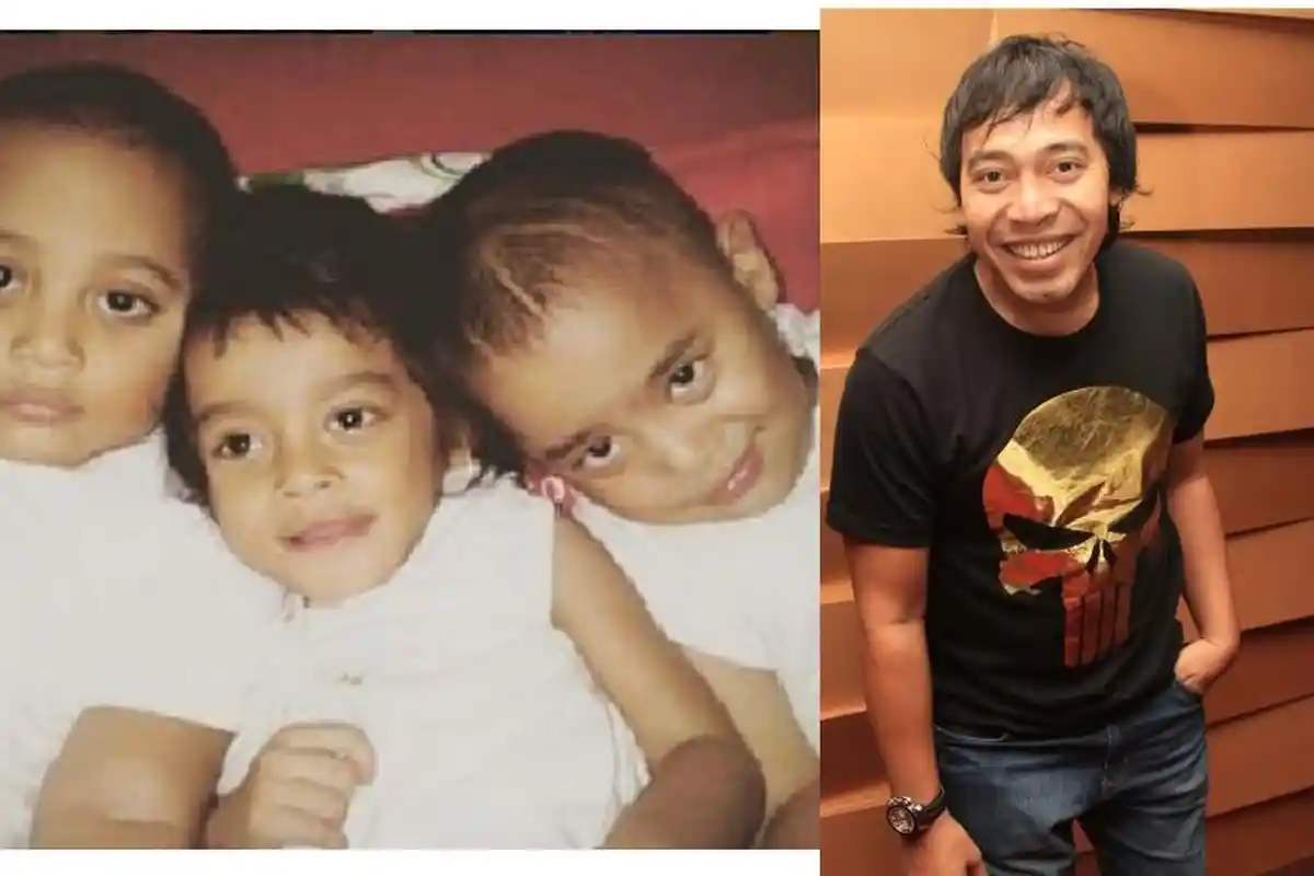 Penyebab Kematian Putri Komeng yang Sesungguhnya Versi Dokter