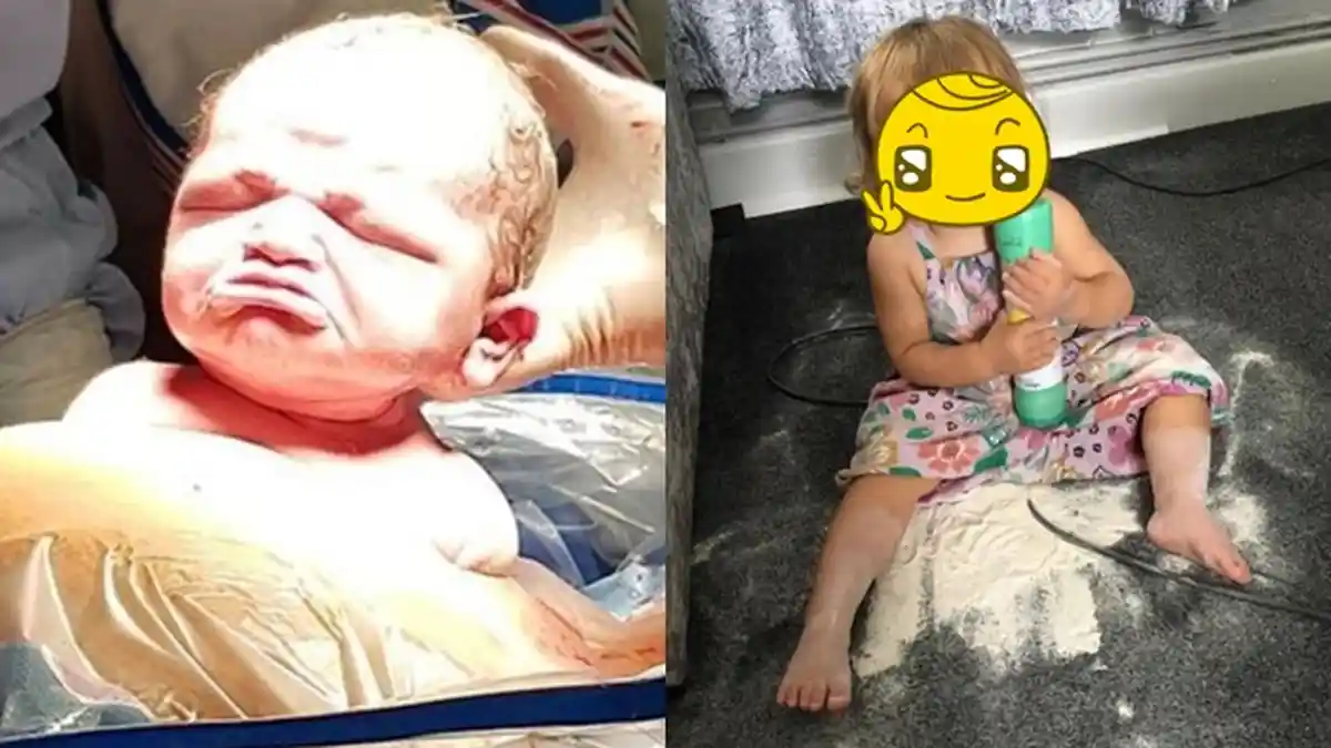 MASIH Ingat Bayi yang Lahir dengan Wajah Cemberut? Lama Tak Ada Kabar, Begini Rupanya Sekarang