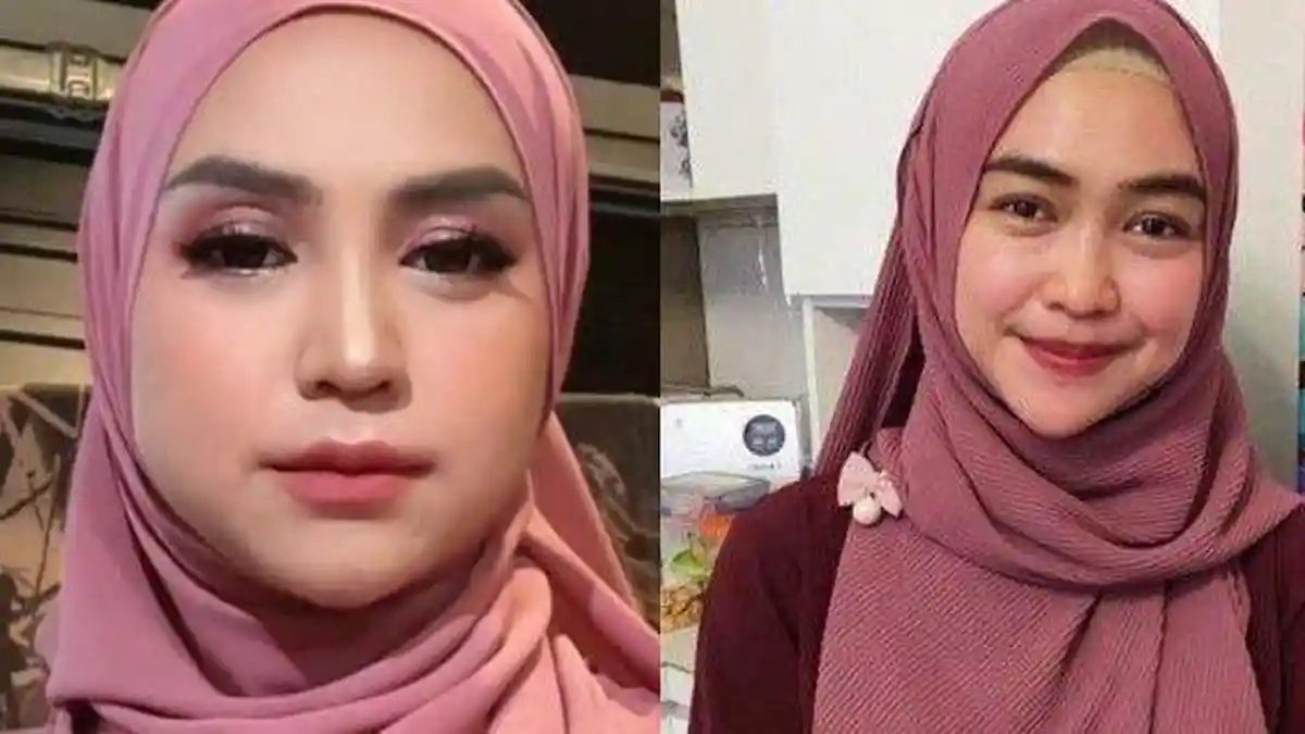 Wajah Ria Ricis Berubah Sepulang dari Thailand, Dituding Oplas