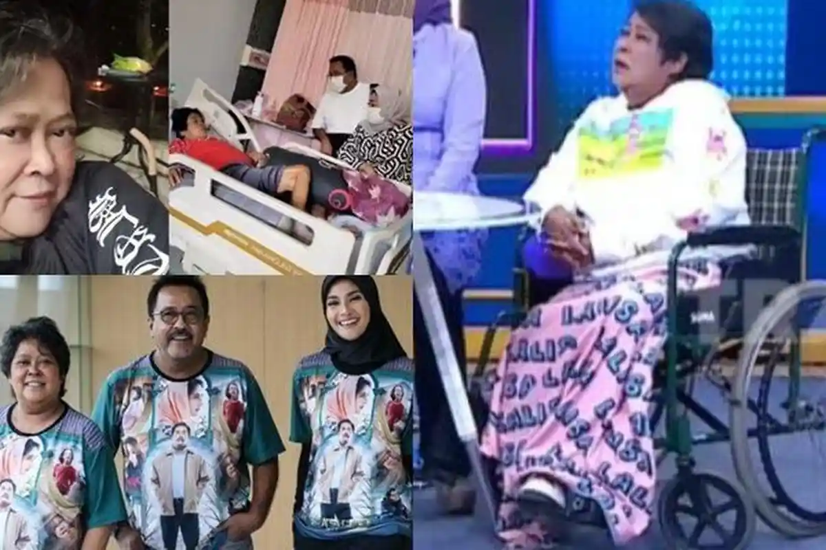 Kakinya Diamputasi, Suti Karno Sesali Masa Lalu, Kini Minta Maaf Sama Allah SWT, Terungkap Sebabnya