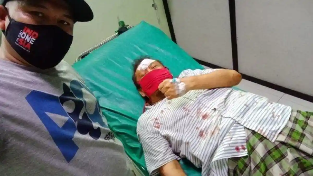 Mobil Politisi PAN Eggi Sudjana Tabrak Pembatas Jalan, Pelipis Robek, Begini Kondisinya Sekarang