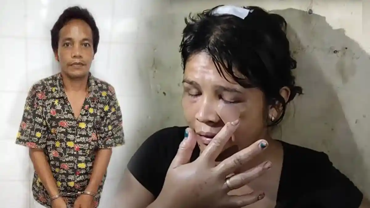 Kondisi Terkini Rina Simanungkalit: Susah Bernafas, Biaya Rontgen Kepala Tidak Ada