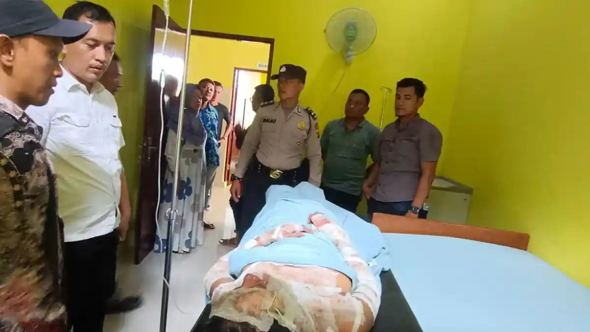 Polisi Buru Suami yang Bakar Istri di Langkat, Disebut Melarikan Diri Arah ke Stabat