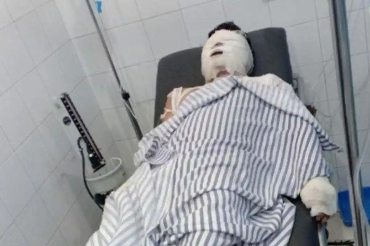 Tak Terima Cintanya Diputus, Pria 55 Tahun Nekat Siram Pacarnya dengan Pertalite Lalu Menyulut Api