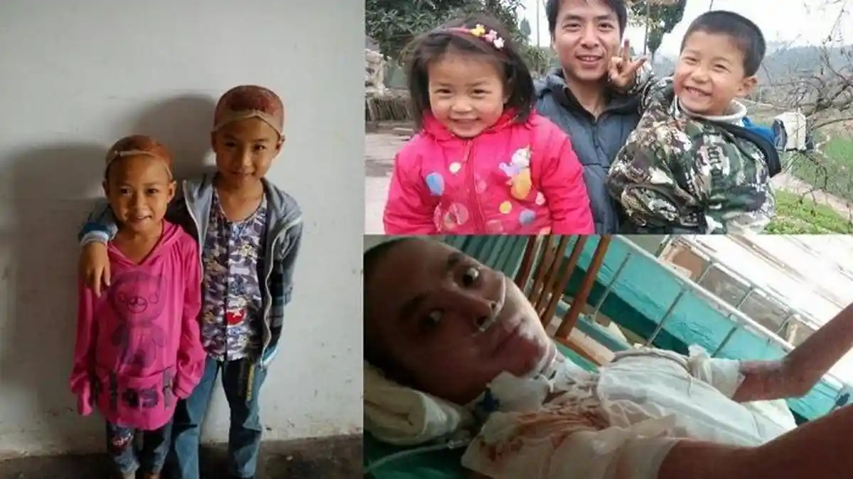 Bikin Haru! Simak Kisah Pengorbanan Kedua Anak Ini Demi Selamatkan Sang Ayah Dari Luka Bakar