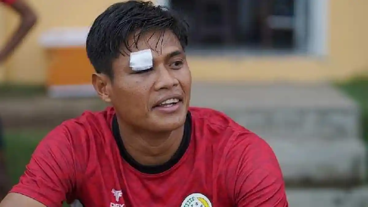Update Cedera Pemain PSS Sleman Fachruddin Aryanto, Alami Luka Robek Diatas Kelopak Mata