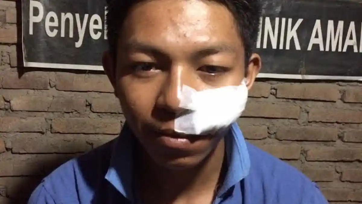 Mahasiswa UMI Korban Begal Belum Laporkan Pelaku ke Polisi