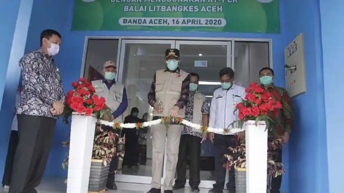 UGM Ciptakan GeNose, Alat Deteksi Covid-19 Via Napas, Begini Cara Kerjanya