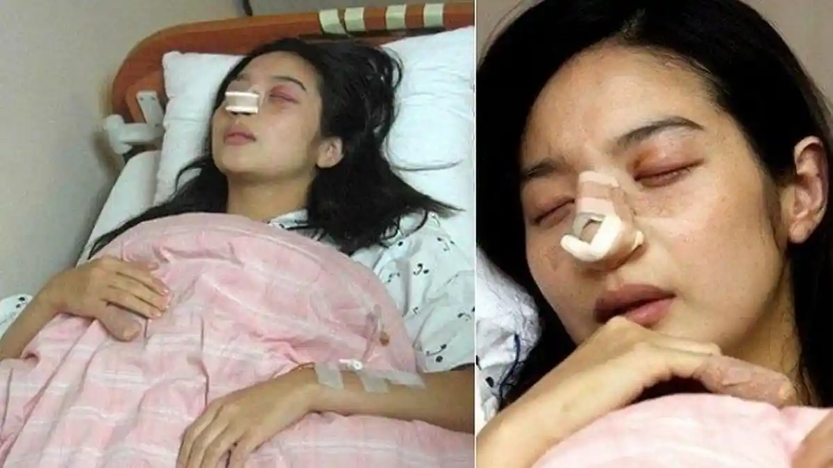Kisah Pilu Artis Cantik Ini, Baru Bulan Madu dari Bali Langsung Bercerai, Wajah Istri Babak Belur