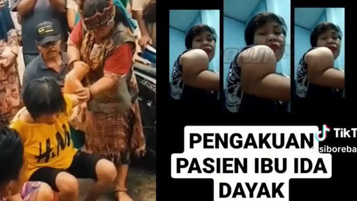 Curhatan Pilu Pasien Tak Sembuh Padahal Sudah Diobati Ida Dayak, Tangannya Cuma Lurus Sementara
