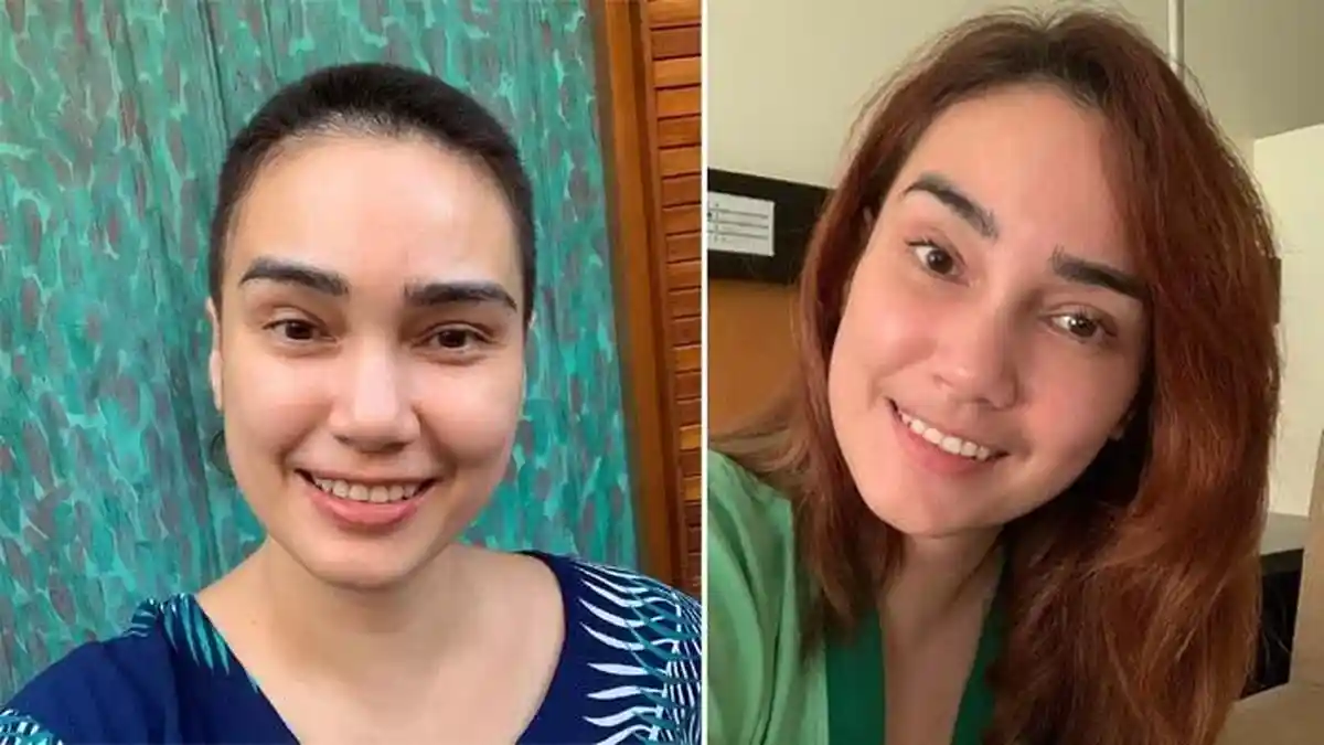 Buka-bukaan soal Penyakit Kanker Ovarium yang Dideritanya, Feby Febiola: Bukan Perkara Mudah