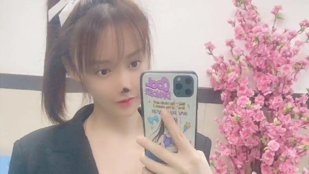 ARTIS Ini Jadi Korban Malpraktik, Kini Wajahnya Jelek, Hidungnya Rusak dan Berwarna Hitam