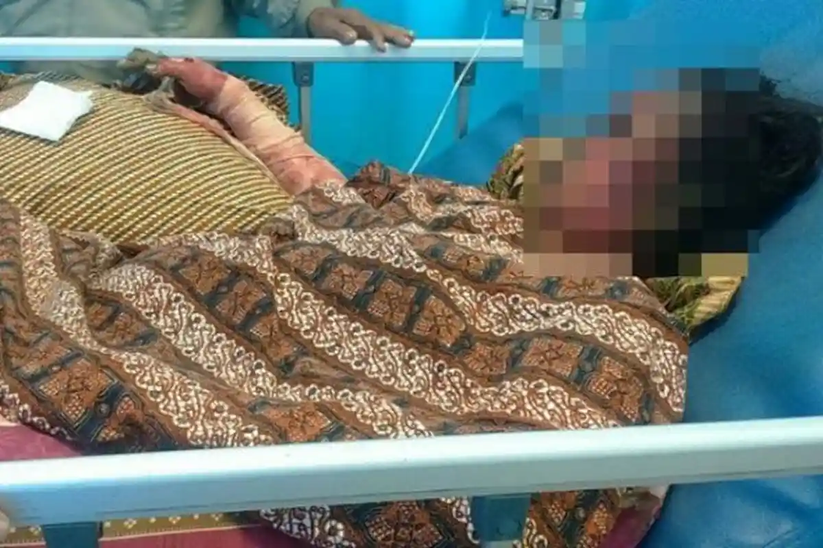 Ngaku Cemburu, Seorang Wanita Tega Bakar Istri dan Anak Mantan Suaminya Sampai Begini