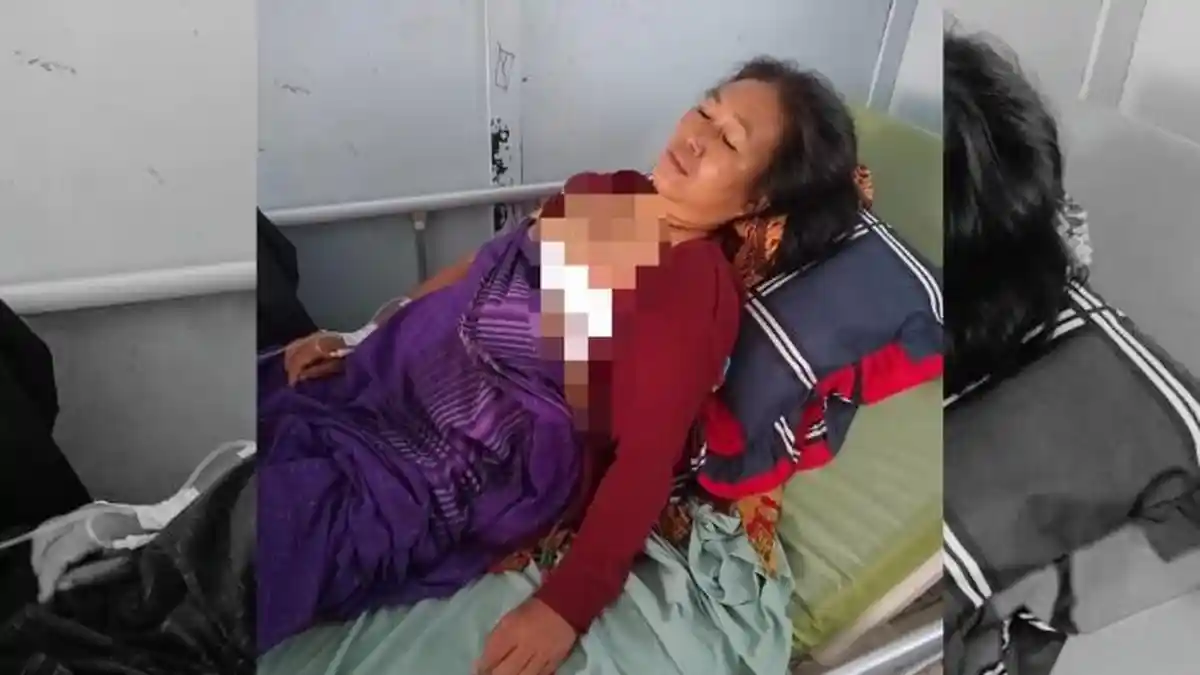 Penderita Kanker Payudara di Bengkulu Utara Butuh Uluran Tangan Dermawan