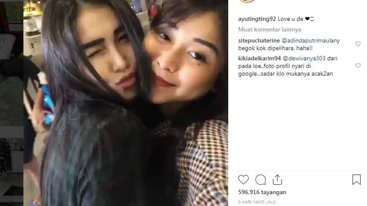 Operasi Lambung, Adik Ayu Ting-ting Ternyata Hampir Tiap Hari Suka Makan Ini