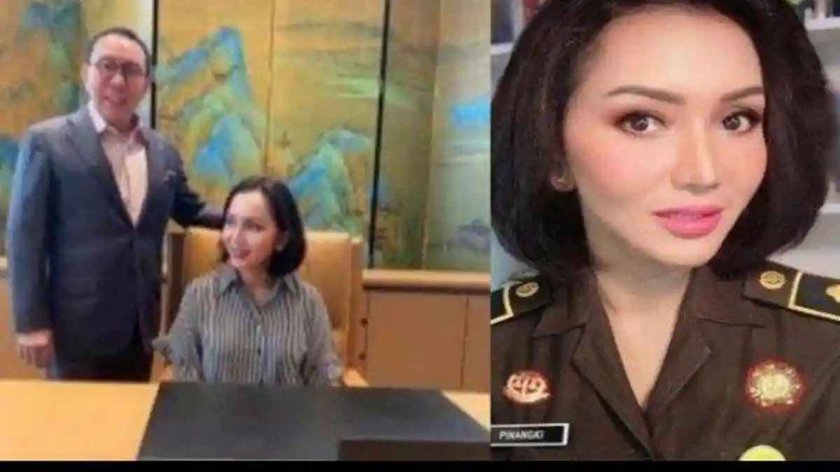 Jaksa Pinangki Operasi Plastik di Amerika Serikat, Segini Biaya yang Harus Dikeluarkan