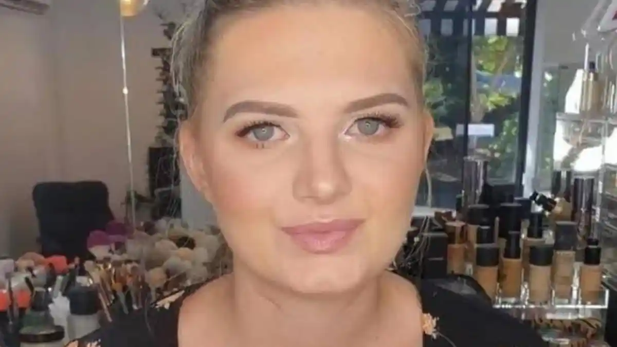 Sakit Gigi Nyaris Bikin Gadis 23 Tahun Tewas, Mendadak Sesak Nafas dan Pingsan