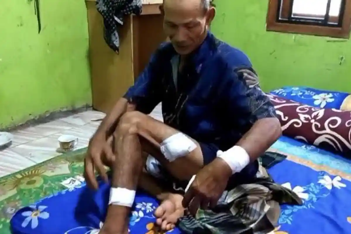 Seorang Kakek Dibacok Kawanan Begal di Wilayah Setu Bekasi, Motor Dirampas