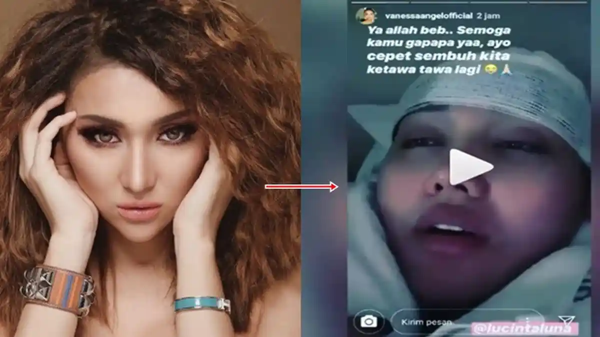 Lucinta Luna Kecelakaan, Eks Duo Bunga Kepala Diperban dan Terbaring Lemah, Manajer Ungkap Fakta Ini