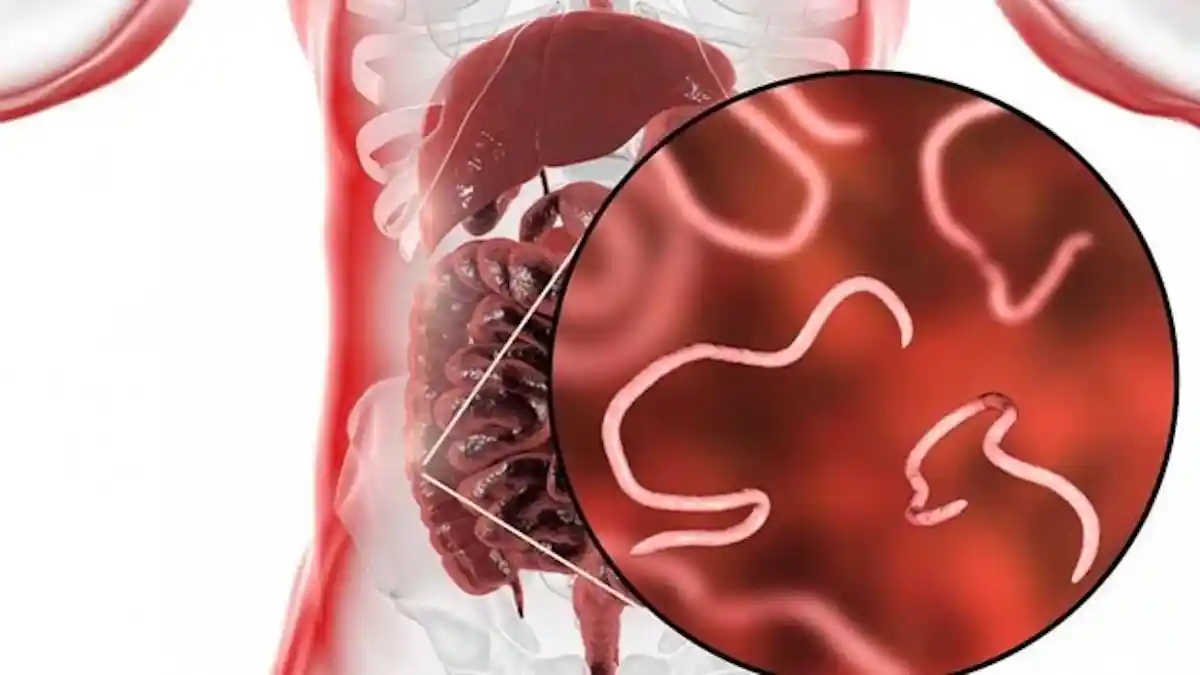 Apakah Orang Dewasa Wajib Rutin Minum Obat Cacing? Ini Penjelasan Dokter