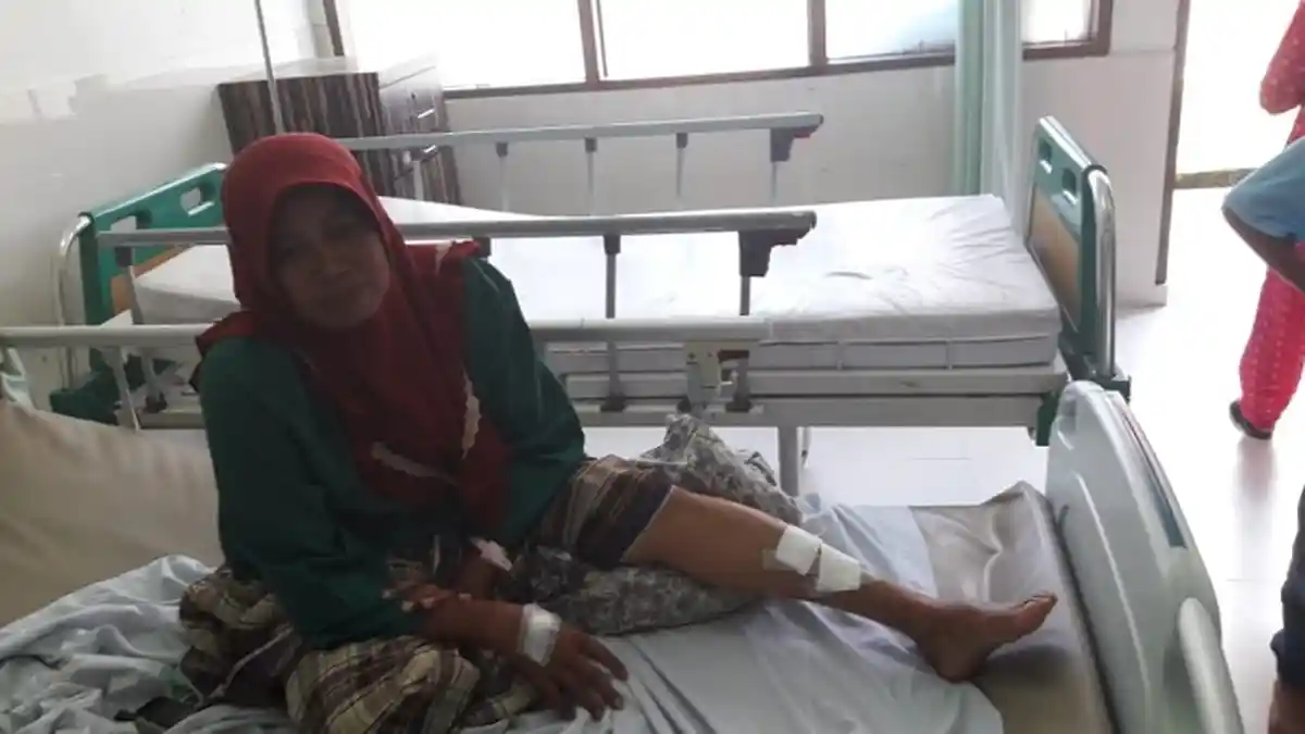 Lolos dari Maut, Gigitan Ular Piton Sisakan Trauma dan Luka di Betis IRT Langsa Baro