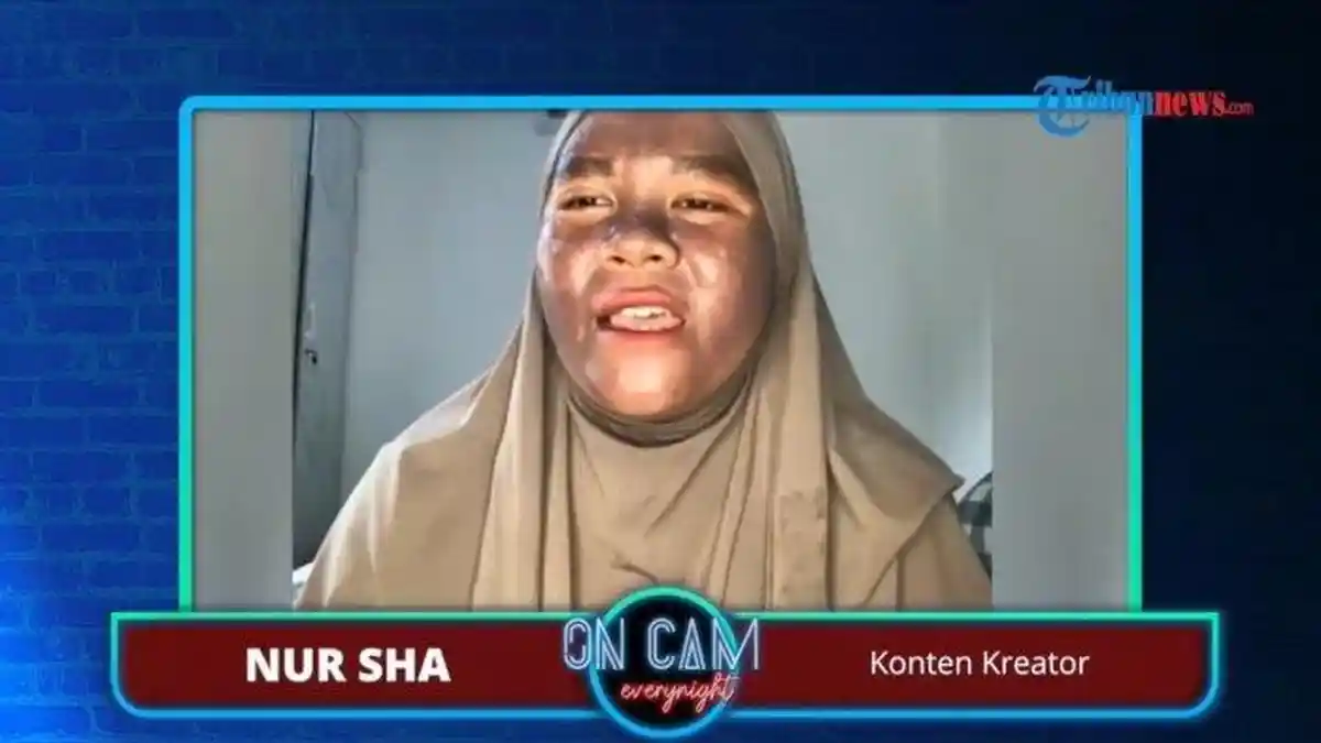Diduga karena Krim Abal-abal Bermerkuri, Kulit Wajah Nur Sha Menghitam dan Gosong