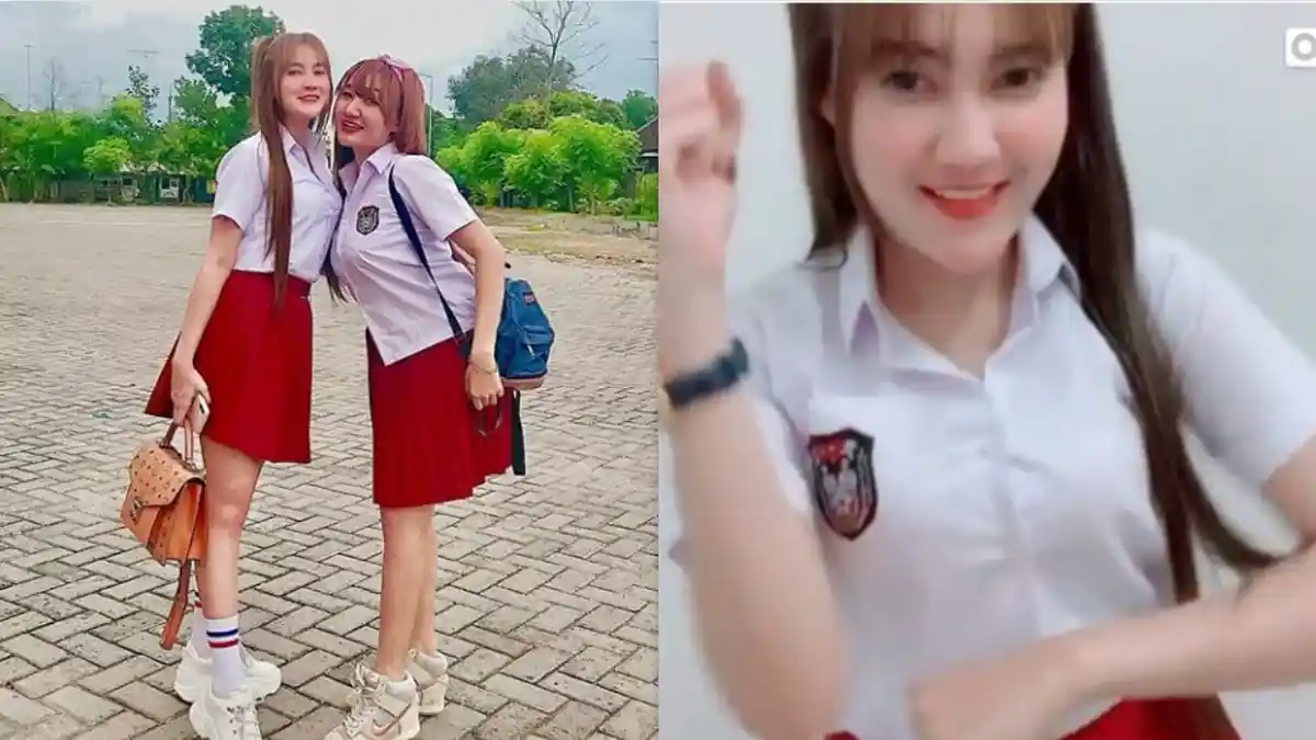 Fakta Bentuk Dengkul Nella Kharisma Jadi Sorotan, Ini yang Bikin Goyangan Jadi Luwes