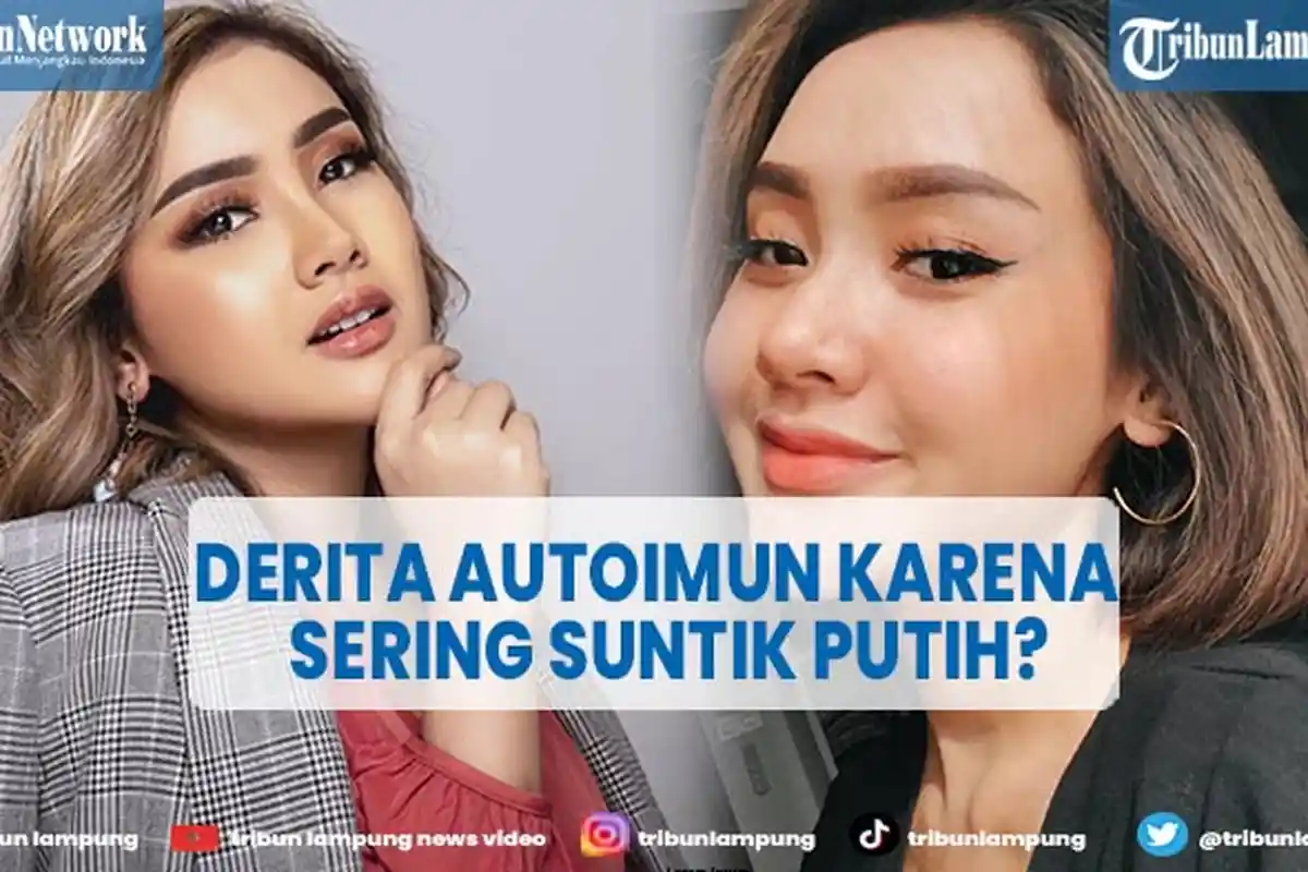 Artis Cita Citata Derita Penyakit Autoimun Gara-gara Suntik Pemutih Kulit?