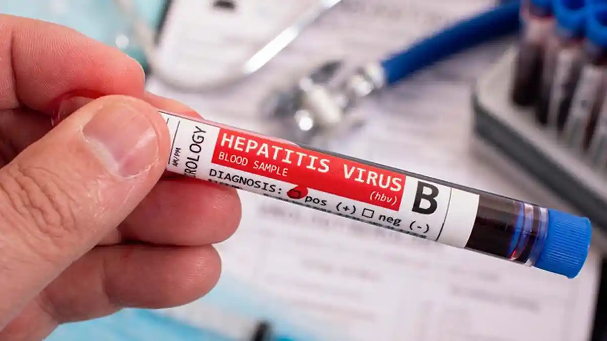 Mengenal Hepatitis B, Berikut Gejala-gejala dan Cara Mencegahnya