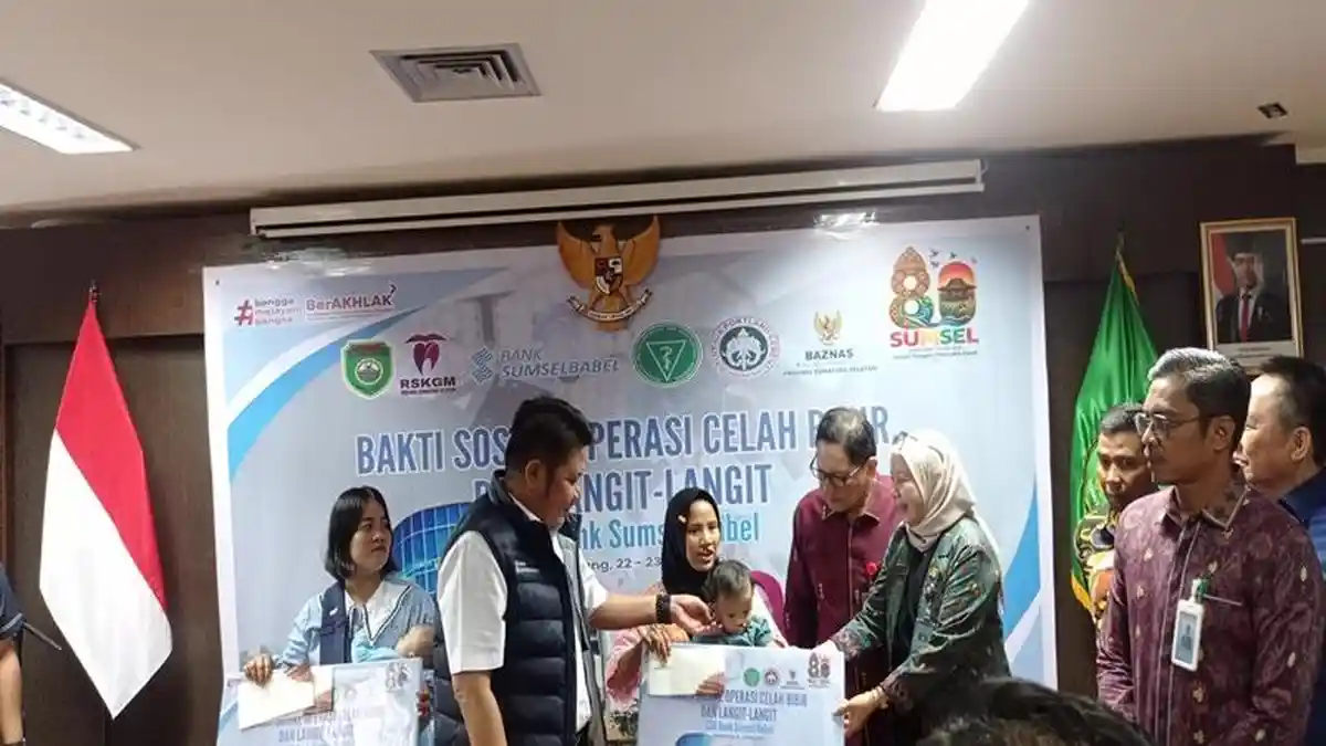 Bakti Sosial Operasi Bibir Sumbing Gratis dalam Rangka HUT Sumsel ke-80 - bsbsumbing1.jpg