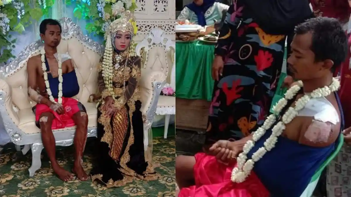 Viral Pengantin Pria Duduk di Pelaminan Bercelana Pendek dan Penuh Luka, Ini Kisah di Baliknya