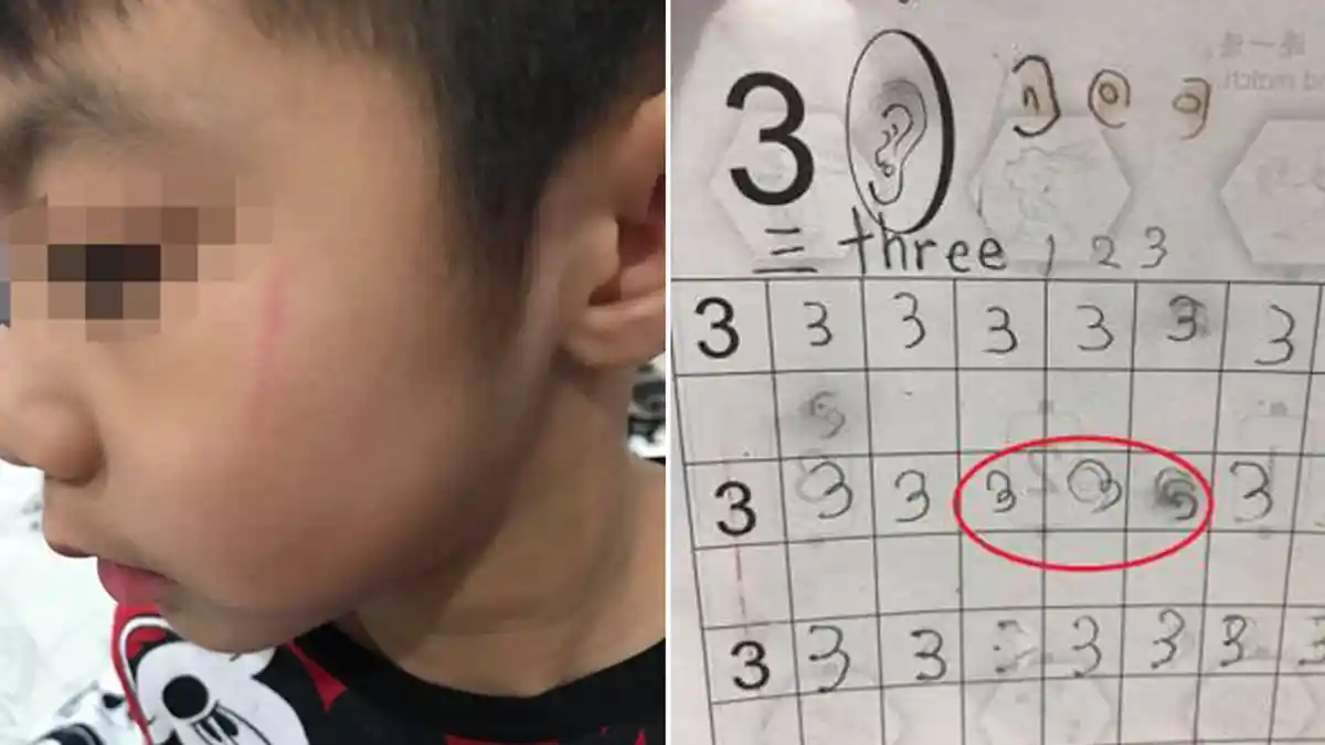 Seorang Murid Diduga Dipukuli Guru karena Tak Bisa Tulis Angka '3' dengan Benar, Langsung Trauma!