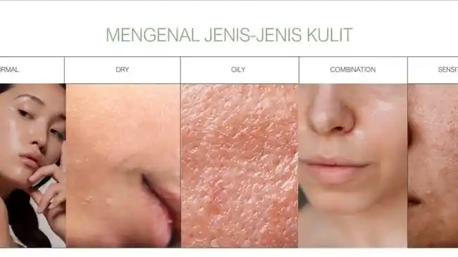 Bercak Hitam Jadi Ciri, Ini Cara Mengatasi Penuaan Dini pada Kulit yang Dipicu Paparan Sinar UV