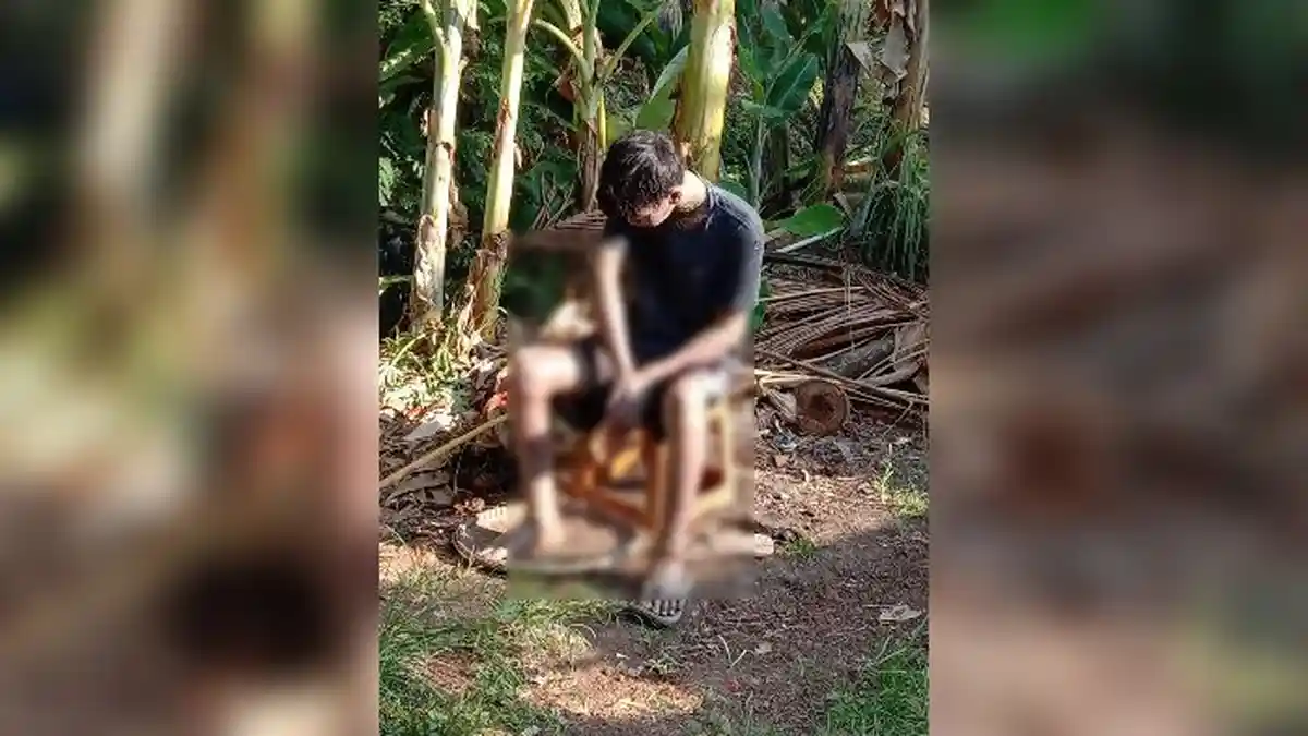 Pemuda di Indramayu Derita Eritroderma, Kulitnya Seperti Bersisik dan Mengeluarkan Nanah