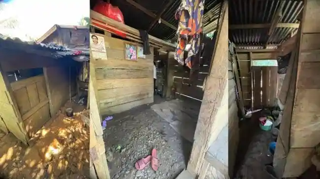 10 Hari Dirawat, Tak Ada Lagi Cacing Bersarang di Tubuh Balita Kakak Beradik di Bengkulu