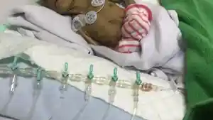 Kondisi-terkini-Nala-pasca-pengungkapan-dugaan-tiga-perawat-melakukan-kelalaian.jpg
