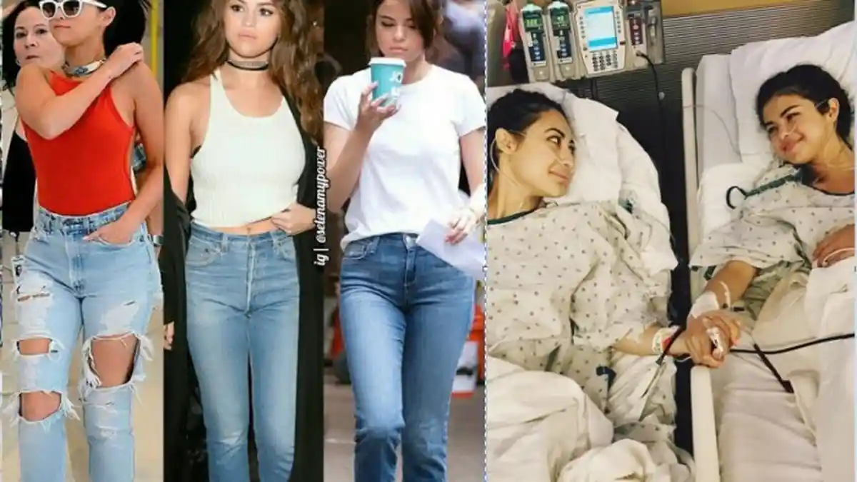 Fakta Berbahaya Penyakit Lupus Sehingga Bisa Memaksa Selena Gomez Cangkok Ginjal