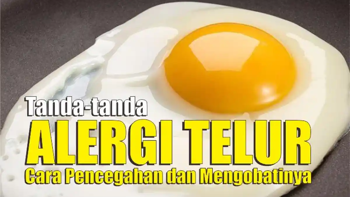 Tanda-tanda Alergi Telur, Cara Pencegahan dan Mengobatinya