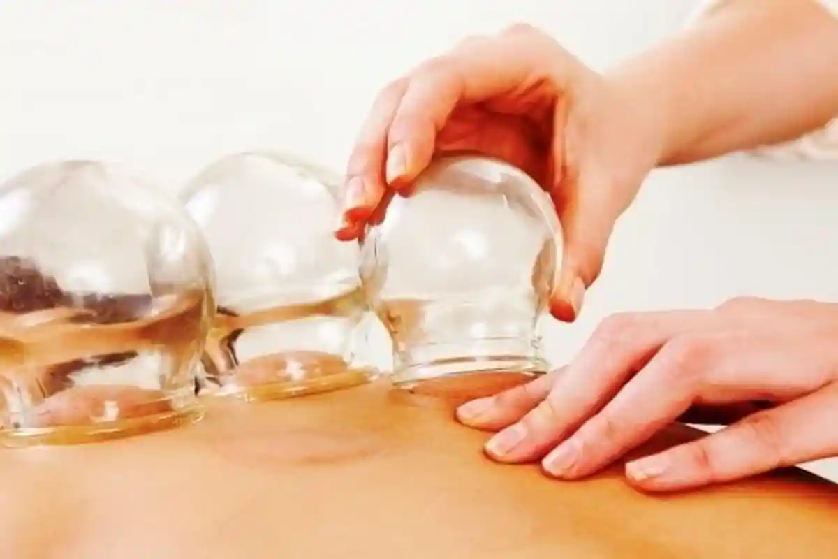 Apa Hukum Lakukan Metode Bekam di Bulan Suci Ramadhan, Apakah Sah atau Tidak Puasanya?