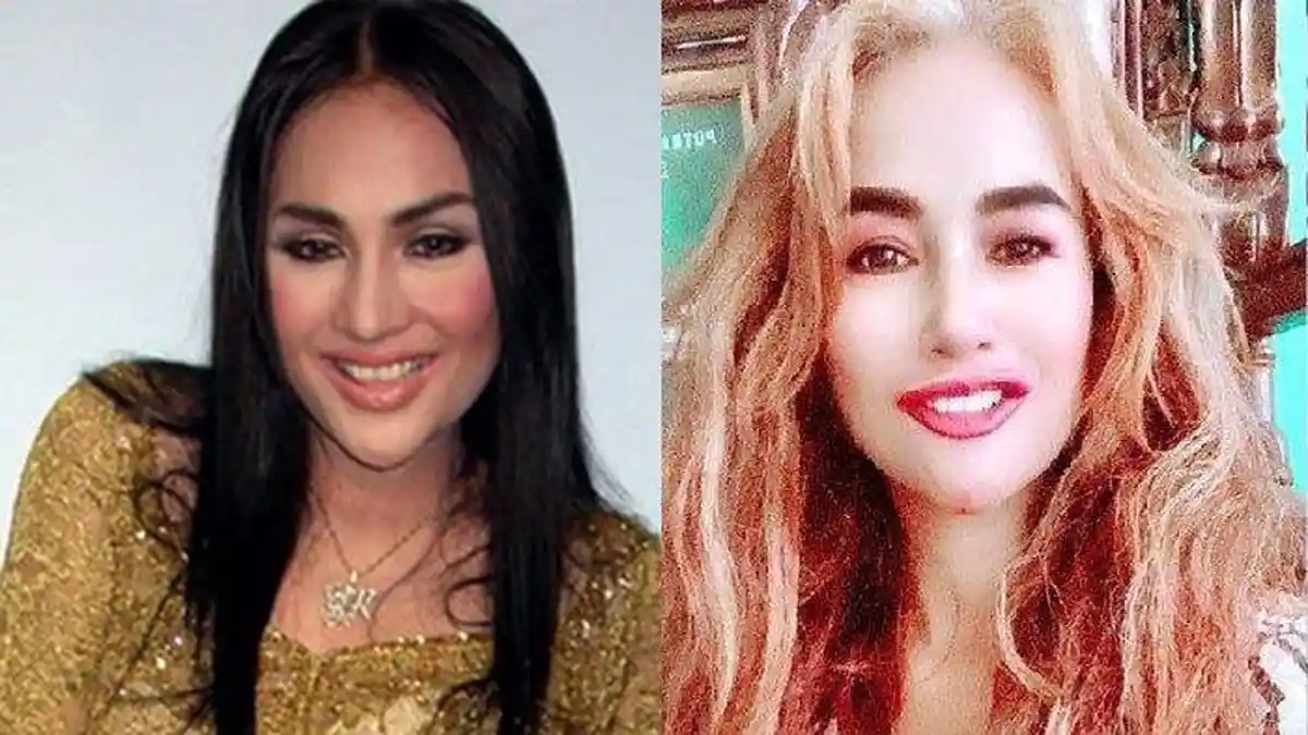 Viral Diisukan Sakit Parah, Begini Kondisi Terbaru Lilis Karlina, Penampilan Sang Pedangdut Berubah