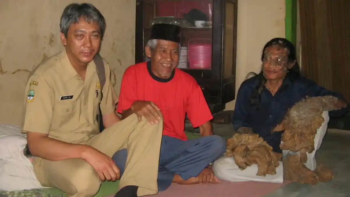 Kisah Dede Manusia Akar Sebelum Meninggal Dunia