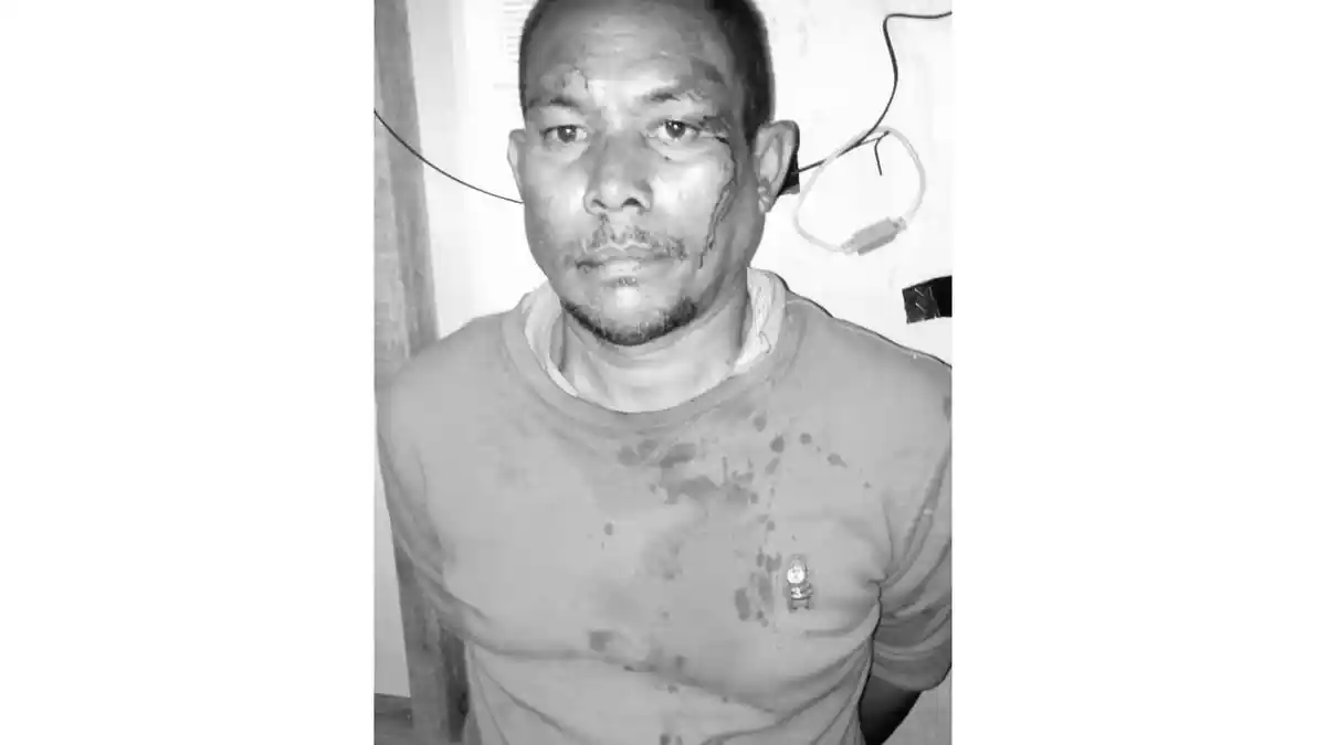 MODUS Beli Onderdil Sopir Sergai Bawa Kabur Sepeda Motor Bos, Wajah Pelaku Luka Lebam Dimassa